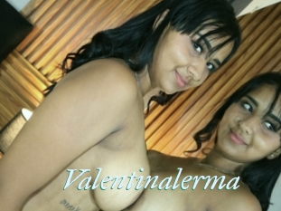 Valentinalerma